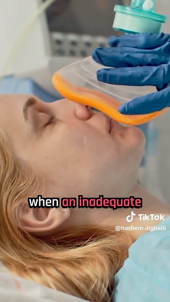 Understanding Anesthesia Awareness During Surgery