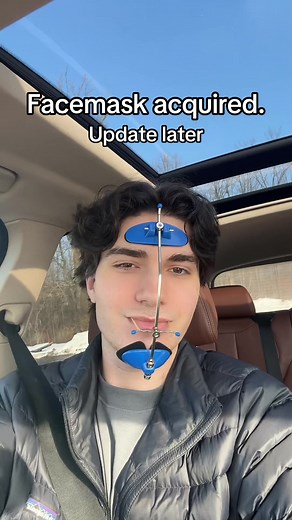 Reverse Pull Facemask Phase Update in Orthodontics