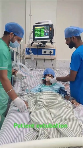 patient extubation in Icu
