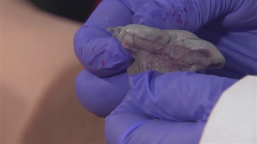 Chemists develop wound sealant