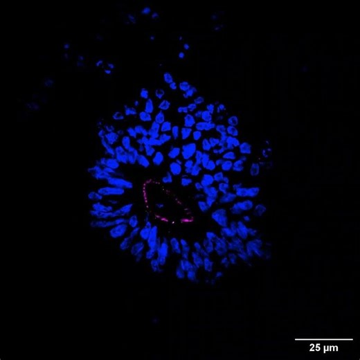 Z-stack Immunofluorescence Imaging of Choroid Plexus Organoid Infected with GFP-N. meningitidis