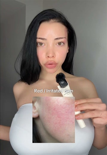 Soothing Red Skin with Cold Cotton Pads