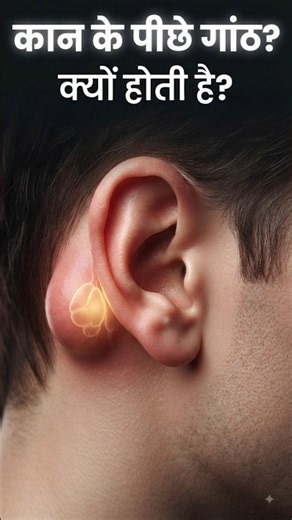 Why do you get a lump behind your ear? Know the real reason! #HealthTips #MedicalFacts #HealthAwa...