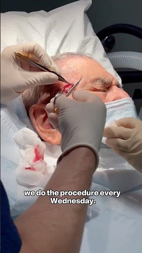 How Mohs Surgery Removes Skin Cancer