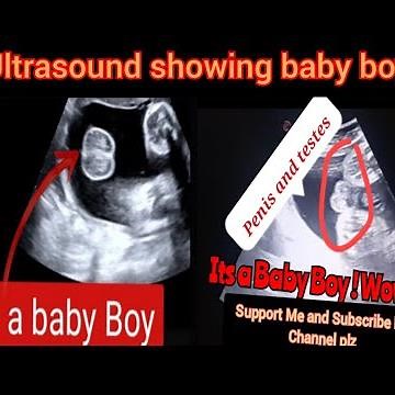 baby Boy Ultrasound | Male baby | Baby Gender