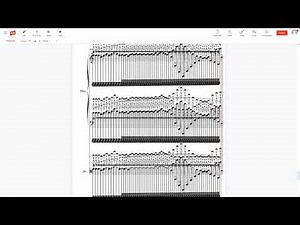 The WORST song you'll ever hear