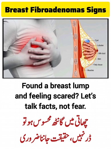 Understanding Breast Fibroadenomas: Causes and Treatments
