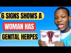 What are the signs of GENITAL HERPES?? 🤔😲You won't believe it !!