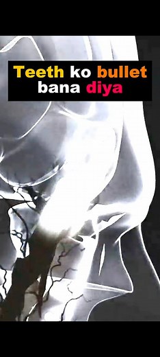 Teeth Ko Bullet Bana Diya. 😱 #filmes2025 #newvideo #bestmovie #newmovie #filmes #movie #HD #videos | Rpwriter Clips