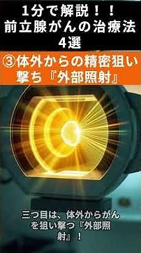 前立腺がんの治療法4選！ #放射線 #雑学#がん治療 #がんサバイバー