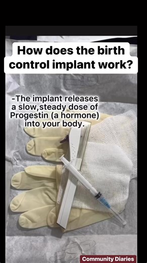 4.6K views · 28 reactions | How does the birth control Implant work? #familyplanning #momtips | Community Nurse | Facebook
