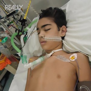 716K views · 14K reactions | The incredible story of a 12-year-old boy who suffered from a brain hemorrhage  #BodyBizarre | Really Channel | Facebook
