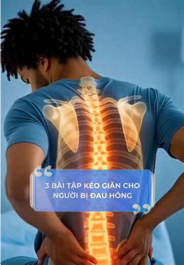 3 bài tập kéo giãn hiệu quả cho người bị đau hông. #bacsikimlien #phuchoichucnang #dauhong #bacsi #tiktok