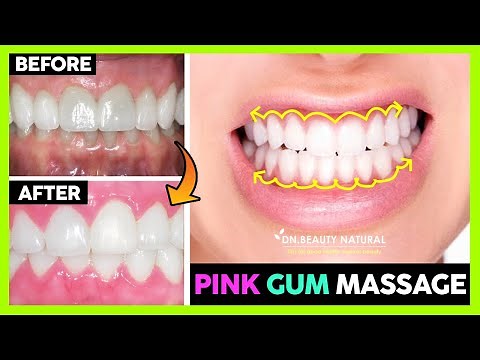 😁 How to Get Pink Gums with Massage | Black Gums to Pink Gums | Healthy Pink Gums Home Remedy