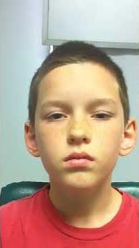 Marcus Gunn jaw-winking syndrome