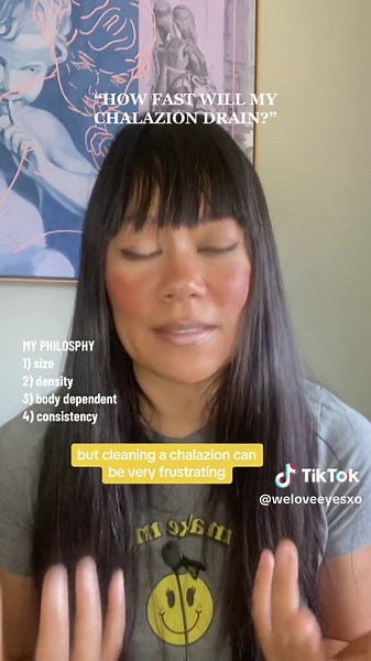 Cleaning and draining a chalazion through the eyelid margin is correct but also frustrating when you got a stubborn one. Ultimately super stubborn ones may need a steroid injection, surgical intervention, and or help via an energy device like IPL #chalazioncleaning #chalaziondraining #chalaziontreatment #chalazionsurgery #chalazionsuccess HOW FAST WILL MY CHALAZION DRAIN? #weloveeyes #weloveeyesxo #drtanyagill @micah @nila