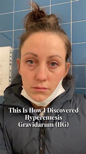 Jes 🌿 HOLISTIC HG & MORNING SICKNESS COACH on Instagram: "This Is How I Discovered Hyperemesis Gravidarum (HG) 🤮 Feeling sick all day every day? Follow to learn how to treat the root causes of your symptoms! #pregnancy #pregnancytips #hyperemesisgravidarum #morningsickness"