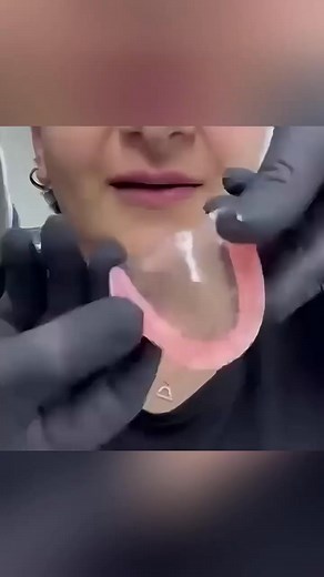 After wasting $5,200 on dentist visits and traditional dentures, these 3-minute custom at-home dentures changed everything. For the first time in 7 years, I feel confident and I can eat steak again!" - Elaine M., 61 Smile with confidence with the self-fitting solution recommended by dental professionals globally 🦷 ✅ Get a perfect fit in minutes, no dentist needed ✅ Eat and speak again without awkward slipping ✅ Looks and feels natural 🟰 Transform your smile forever! 180-Day Smile Guarantee. Ze