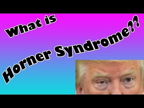 Horner's Syndrome Explained