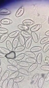 70K views · 550 reactions | Stool sample  #lablife #microbiology | Lab life | Facebook