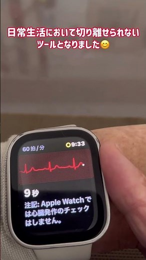 【Apple Watch心電図】心房細動のシグナル発信