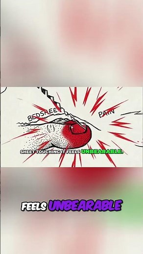 Gout or Infection Know the Difference! Urgent Symptoms