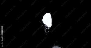 CT scan of the brain for diagnosis brain tumor,stroke diseases and vascular diseases.