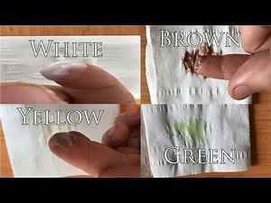 Discharge colors and their meaning