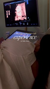 41K views · 216 reactions | congenital anomaly scan + 3D utz at 24 weeks  thank you Hello Baby Ultrasound 冀勺 | Kelsey Buan-Gonzales | Facebook