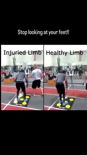 QuickBoard on Instagram: "How many athletes are returned to play who have this “poor connection”? Stop the exercises where you look at your feet It’s not how your body functions. In training and rehab settings, are you emphasizing external focus, cognitive-motor, and dual/multi-task exercises? If the body is trained or rehabbed as it functions, expect better outcomes. This D1 football player broke a bone in his left foot, had surgery, rehabbed, and played in the spring game! Because he’s focusin