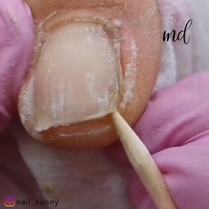Run out of pedicure ideas? No worries! We've got you covered 😊 | MetDaan Nails