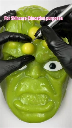 Massive pimple on Hulk’s forehead - popping it is so satisfying! Relax asmr#artificialskin #siliconemodel ##education #oddlysatisfying | Bonnie Pimple popperr