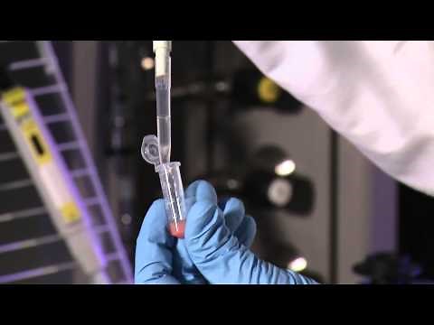 Smart Drug Delivery System