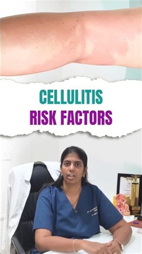 Cellulitis Is NOT Just a Rash ⚠️ Are You at Risk? #doctor #shorts #doctorspeak