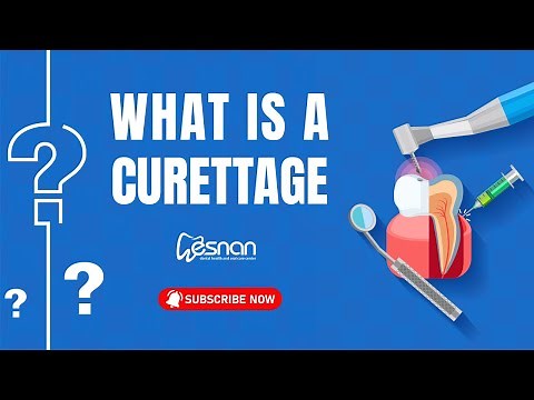 Subgingival Curettage Procedure of Dental Patient | Esnan Dental Clinic