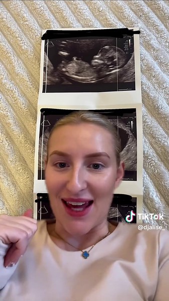 Understanding Nub Theory: Insights and Predictions