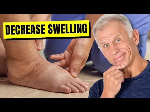 Stop Your Foot & Ankle Swelling (All You Need to Know!)