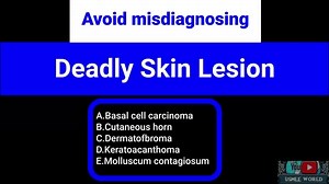 @usmleworldQA on TikTok