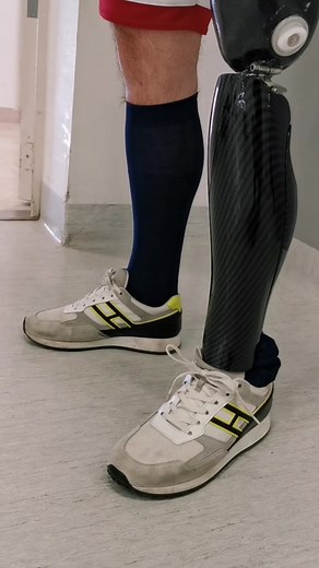 Custom Prosthetic Leg Cover | Rogaenna Disability Accessories