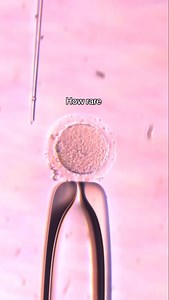 99K views · 592 reactions | How rare & beautiful indeed  #ivf #embryology #ttc #fertilityjourney #ivfjourney #ivfsuccess #ivfbaby #embryo #ttccommunity #embryologist #lab #fertility #infertility #infertility | Arbor Fertility | Facebook