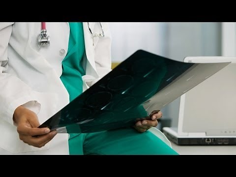 What Is Photosensitive Epilepsy (PSE)? | Epilepsy