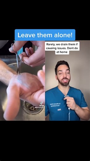 what is thattttt #dermatologist #reactionvids #pimplepopping #fyp #blister #cyst | Doctorly