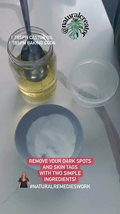 Lighten and remove your dark spots with Castor oil and baking soda! #castoroil #bakingsoda #naturalremedieswork #darkspottreatment #DarkSpotRemover #skintagremover | Natural Creator