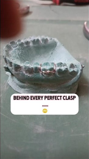 Ortho:They judge in 5 sec, but struggle for 3 hours🫣🦷✨|| Clasps #youtube 🤍✨