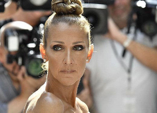 Celine: I Have An Incurable Disease That'll Make Me A Statue