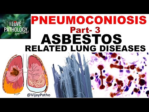 PNEUMOCONIOSIS Part 3: ASBESTOS related lung diseases