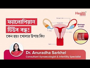 Fallopian Tube Blockage: Causes, Types & Treatment | How to open blocked fallopian tube?