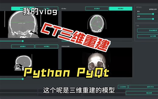 Python PyQt CT三维重建，CT数据导入包围框切割，虚拟切割，模型导出