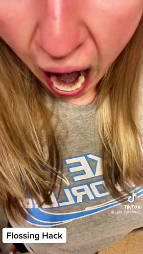 Oh the things I’ll do for TikTok. But ya’ll know I love myself a good lifehack. In all fairness this flossing hack was a game changer since I have a permanent bottom retainer. #lifehackvideo #flossing #permanentretainer #teethcare #teethcleaning #braces