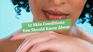 From chronic diseases to short-term infections, these are the top skin conditions — and symptoms — you should watch for. | Everyday Health